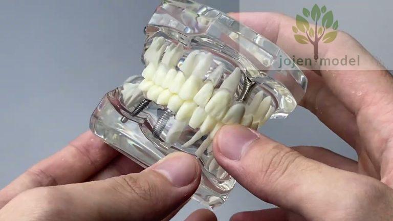 Dental Demonstration Models Best,Oral surgery Model Custom Made,Oral surgery Model Factory Chinese,