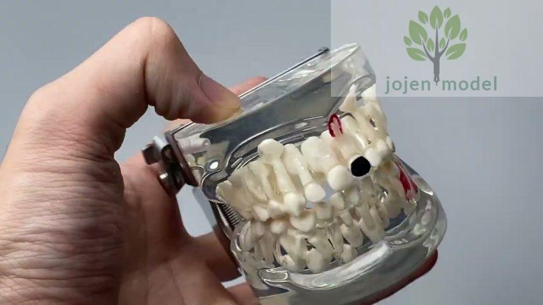 Dental Patient Education models customize,Dental bridge model,Dental Patient Education models price,