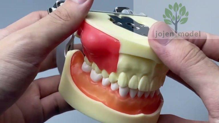 Dental Models for Patient Education,Caries Tooth Model Chinese customize,endodontics animal model