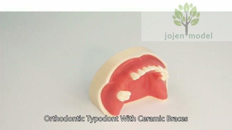 crown and bridge demo model price China Factory,Demo Educational Model for Implant Denture,