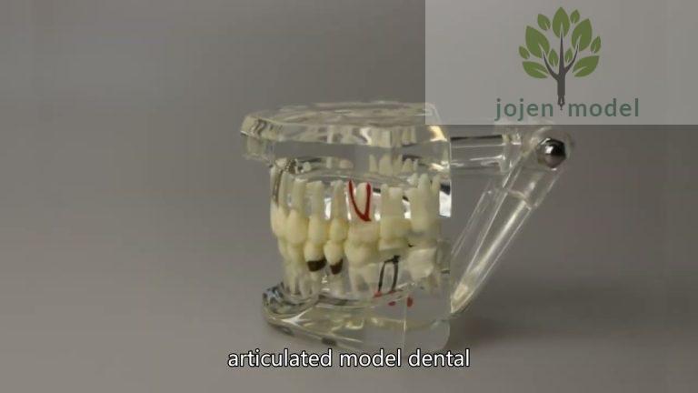 crown and bridge demo model price China Manufacturer,How to use dental implant education model,