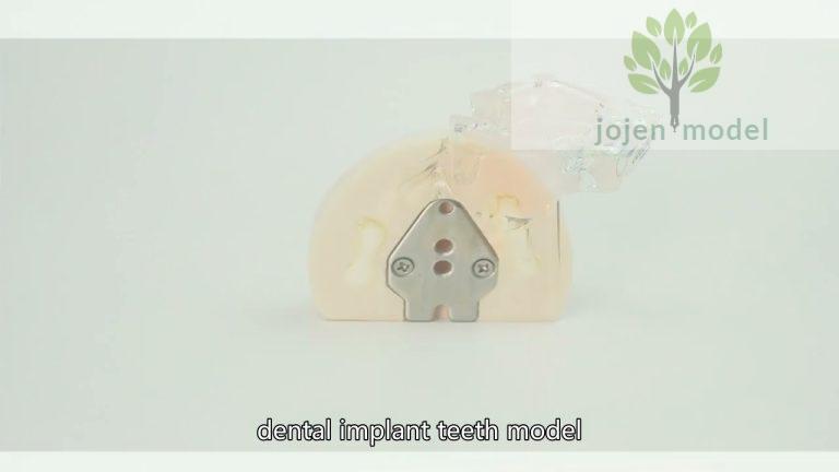 Typodont Model price China Factory,dental model with removable teeth China Best Supplier,