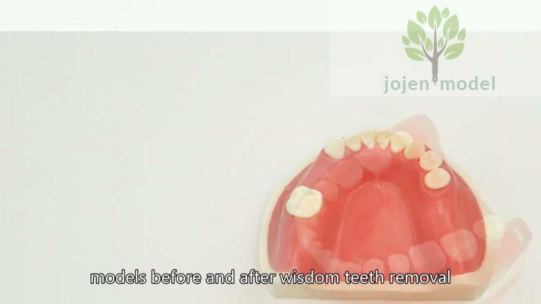 dental teeth study model China High Quality Supplier,dental model with removable teeth China Best