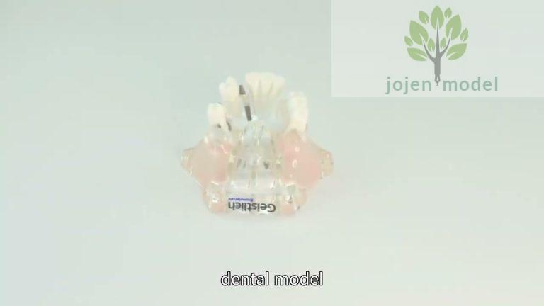 paradigm dental demonstration models China customize,Typodont Model China Best Supplier,