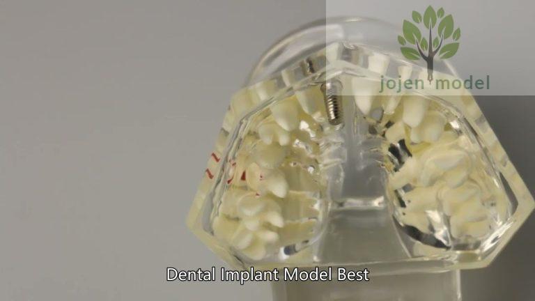 dental implant model study China Company,Educational Model for Implant Denture High Quality Company,