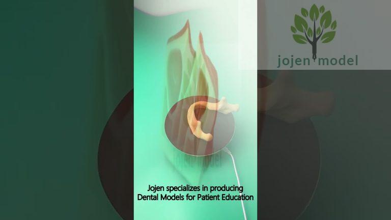 patient education models dental China Factory,Dental Cosmetic restoration combination customize.