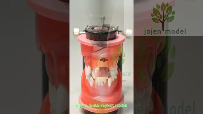 4 Implants Over Denture Model 2 Parts china manufacturer,china customize.