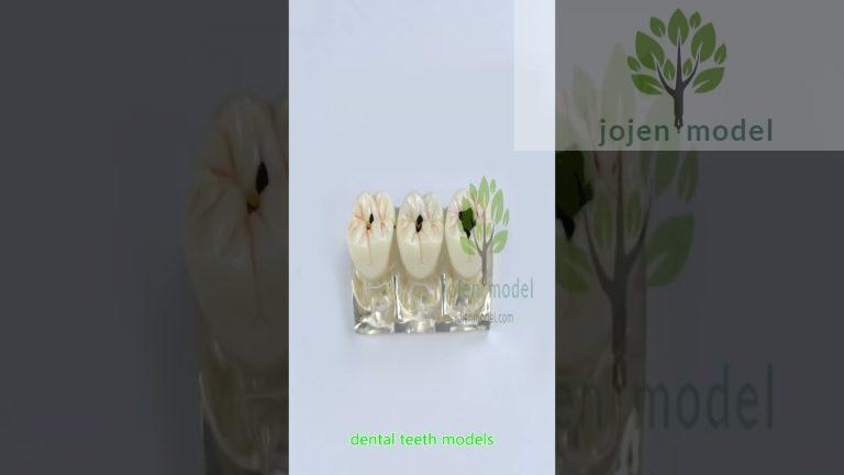 dental model for patient education china manufacturer,china factory.